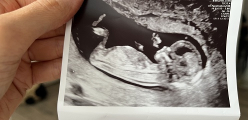 Take a guess… boy or girl?!