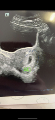 Babies Due April 2023 Thread 4 