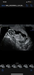 Girl or boy?