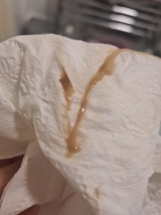 6 weeks strange discharge help!!
