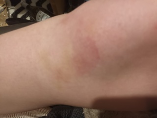 A should I go to A&E one...