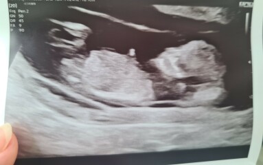 Due March 2023 - thread 3