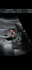 Girl or boy?
