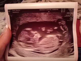 12 week scan - baby gender guesses ??