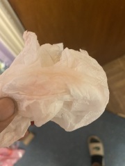 Implantation bleeding