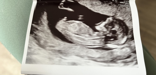 Take a guess… boy or girl?!