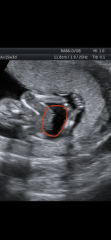 Girl or boy?
