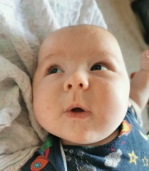 Is this CMPA rash or baby acne? 