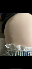 What are these spots - bed bugs?