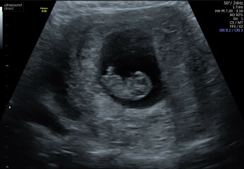 Babies Due April 2023 Thread 4 