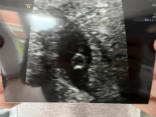 Babies Due April 2023 Thread 4 