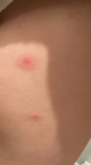 What are these spots - bed bugs?