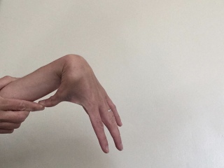 Can you do this to your arm? *PICTURE ATTACHED *