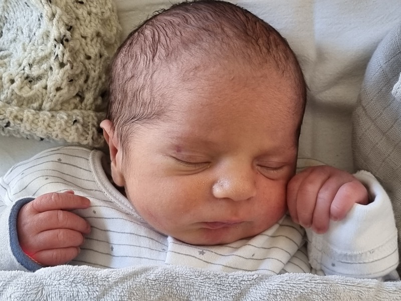 21 week anomaly scan