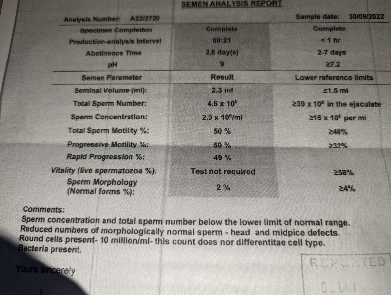 Sperm analysis - please help!!