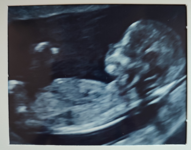 Babies due April 2023 Thread 6