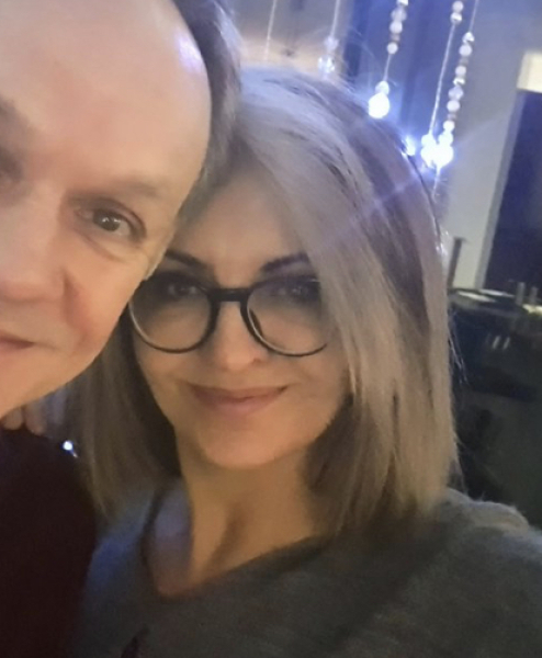 Dark hair going grey. 