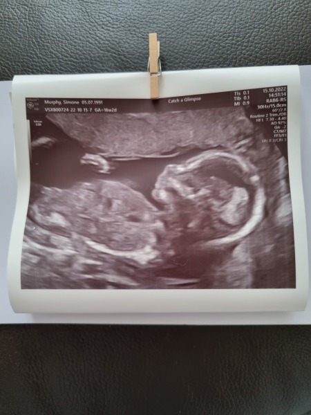 IVFers Due Mar & Apr 2023