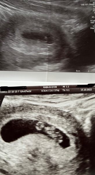 June 2023 Babies 🌞