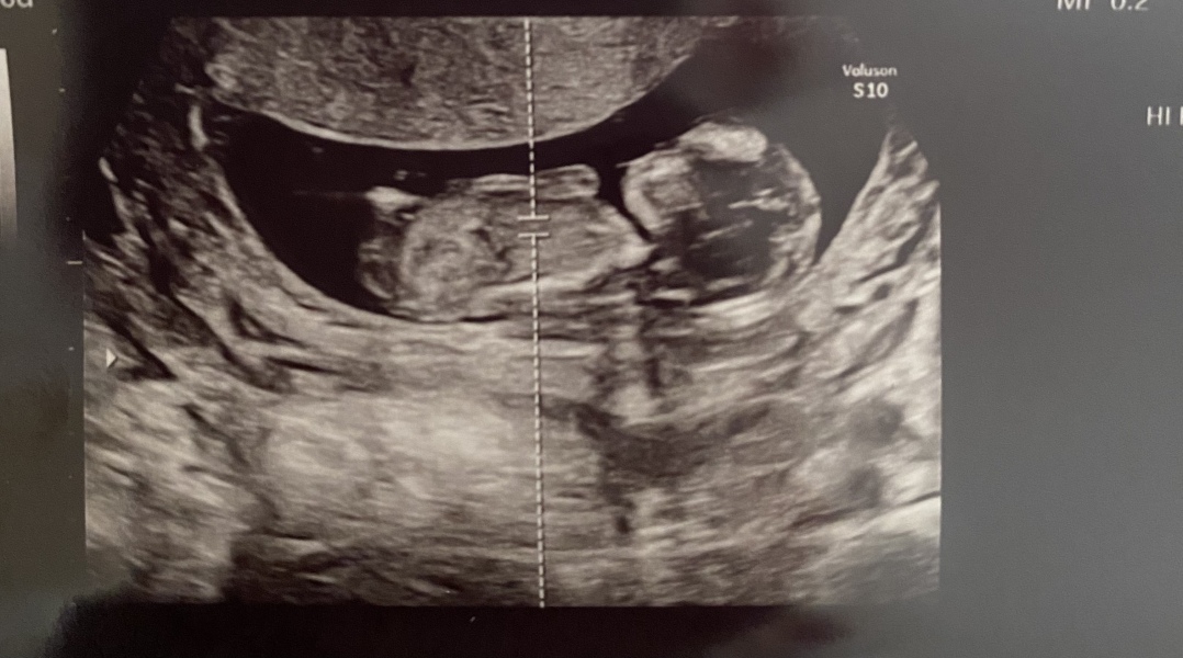 Babies due April 2023 Thread 6
