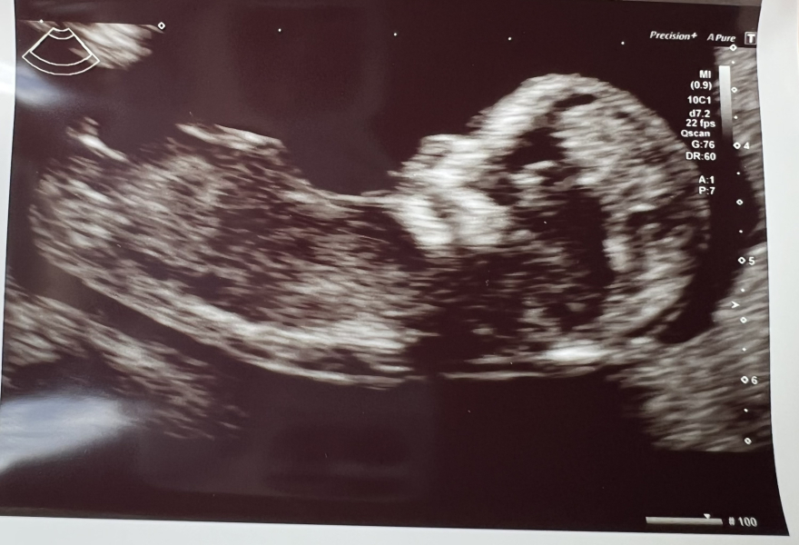 Babies due April 2023 Thread 6