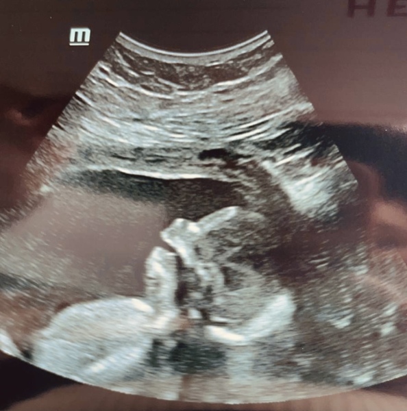 Due April 2023 💕 into the second trimester 🍂🎇