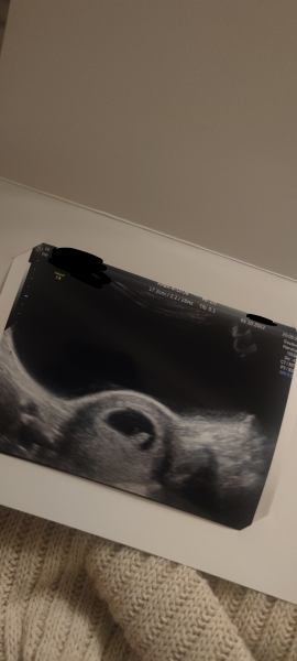 7+4 early scan?