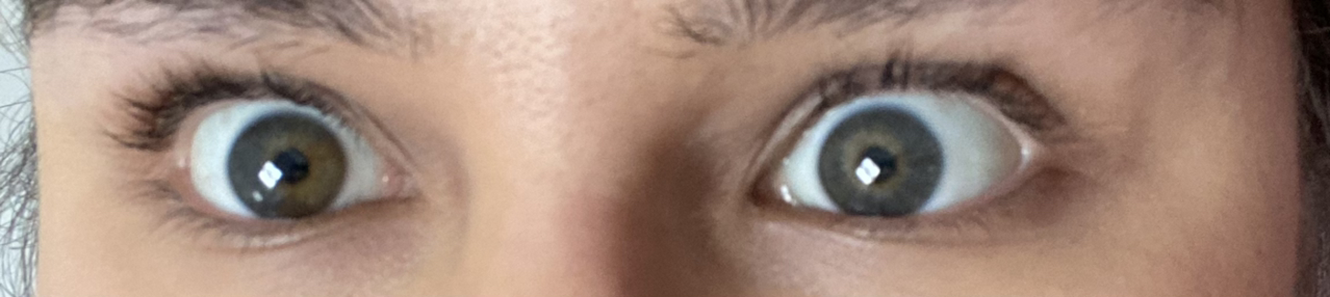 Are these crows feet?
