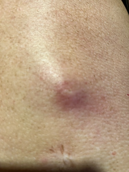 My new friend has gone