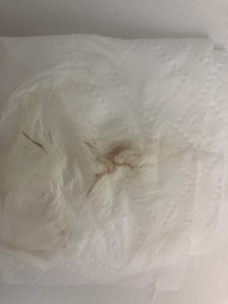 8DPO… anyone else!