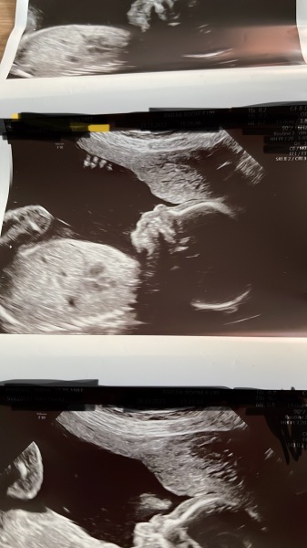 IVFers Due Mar & Apr 2023