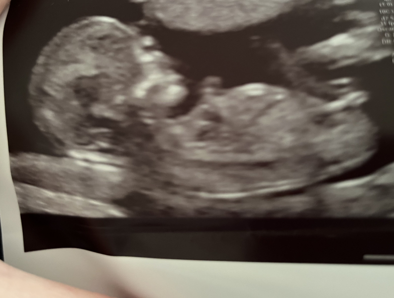 Babies due April 2023 Thread 6