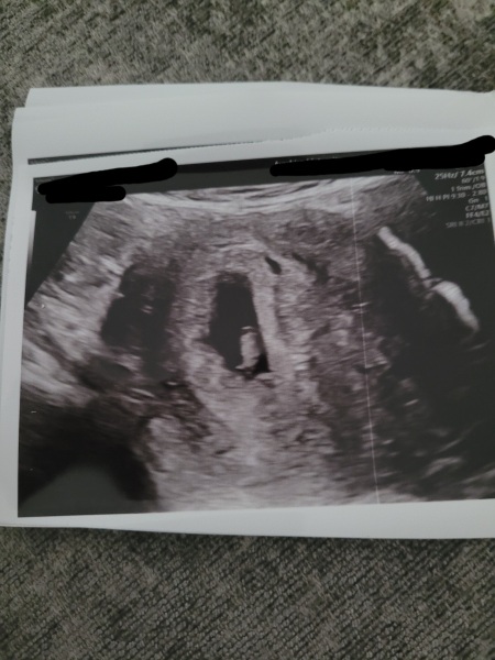 Babies due April 2023 Thread 6