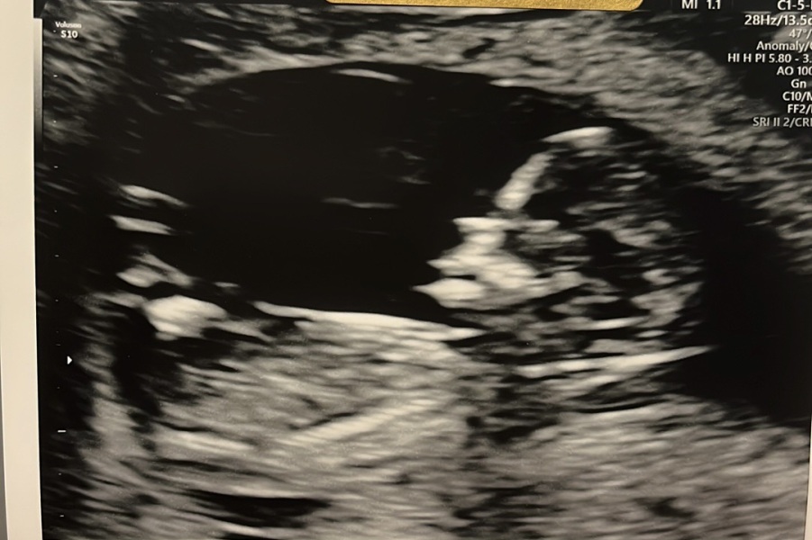 Gender?