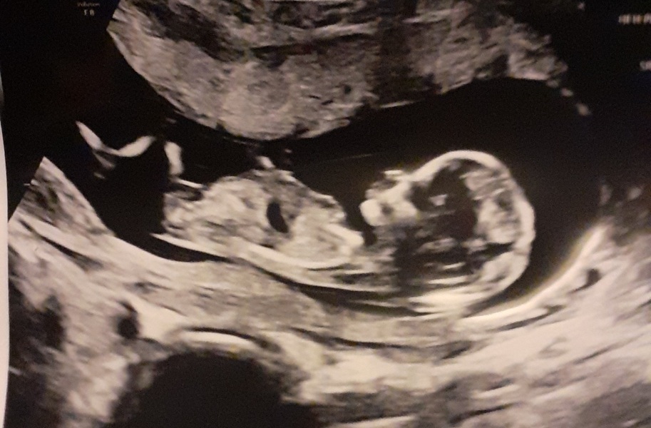 Any guesses on my babys gender?