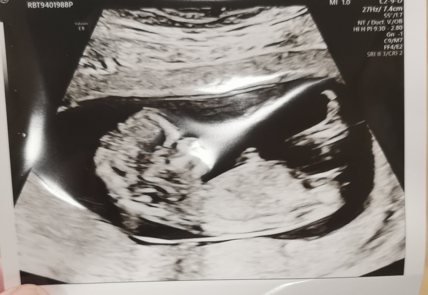 Babies due April 2023 Thread 6