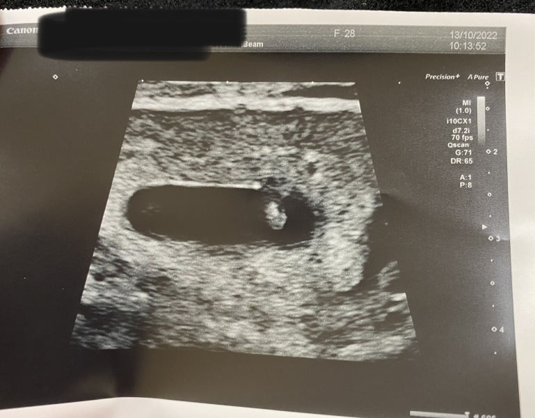 Navigating pregnancy after loss thread 5!