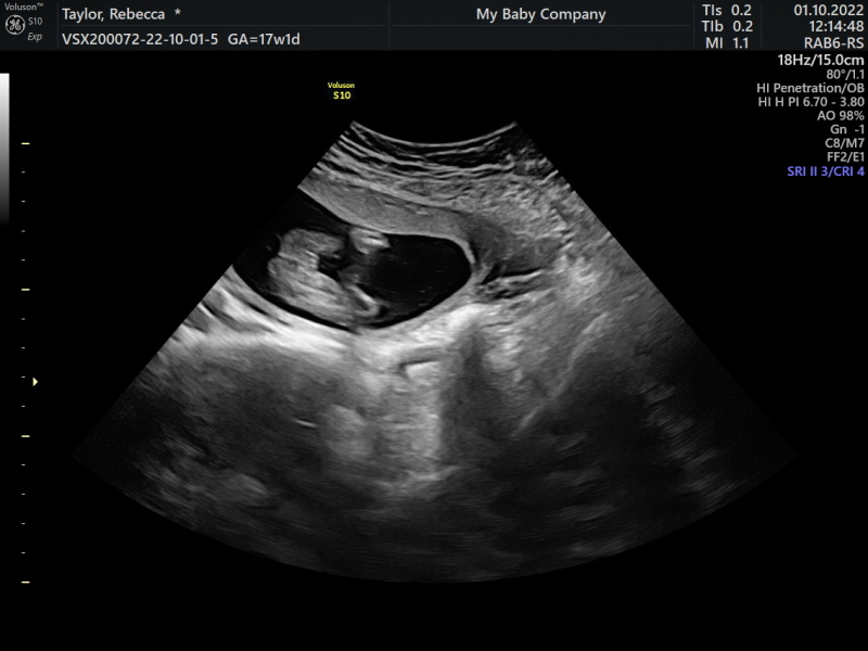 Boy or girl? Potty shot!