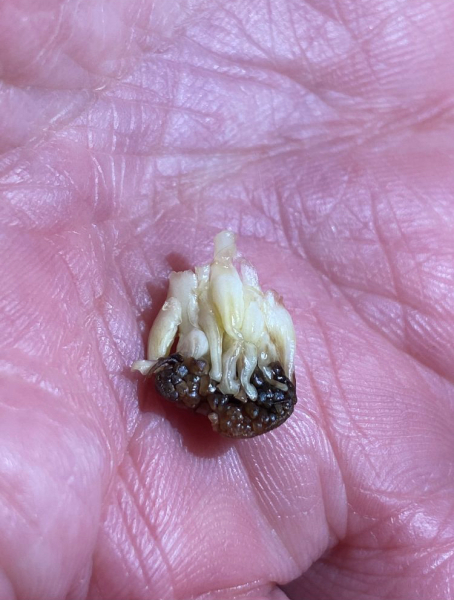 AIBU to be scared of what I found in my McDonald’s (pic 🤢)