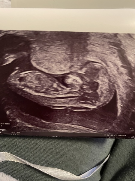 Babies due April 2023 Thread 6