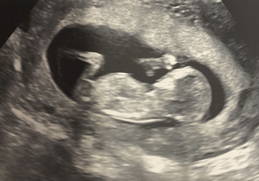 Babies due April 2023 Thread 6