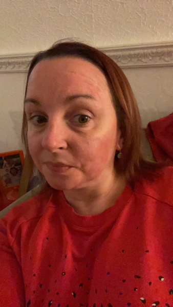 Please help identify this rash