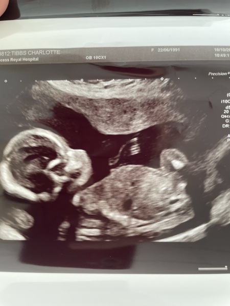 Gender Guesses?