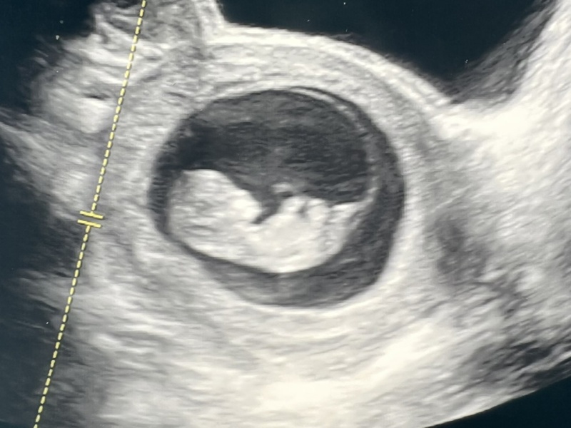 Babies Due April 2023 thread 5