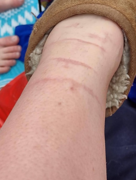 Thinking of paying for a blood test. What do I go for?