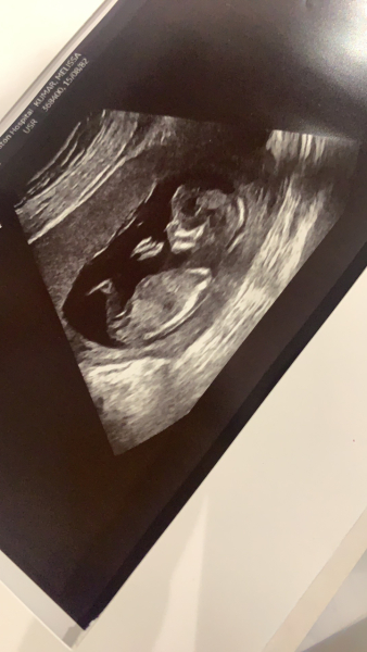 IVFers Due Mar & Apr 2023