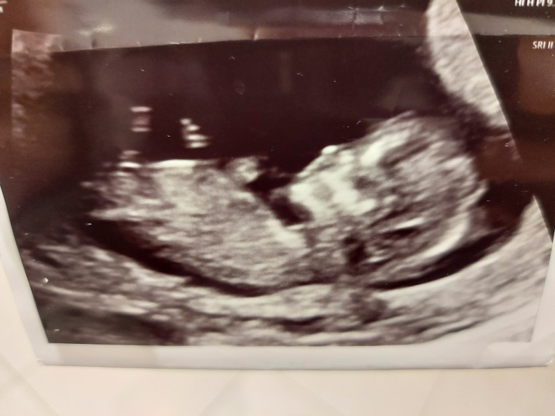 Babies due April 2023 Thread 6