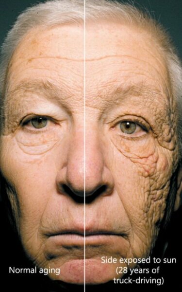 How not to burn on sunbed?