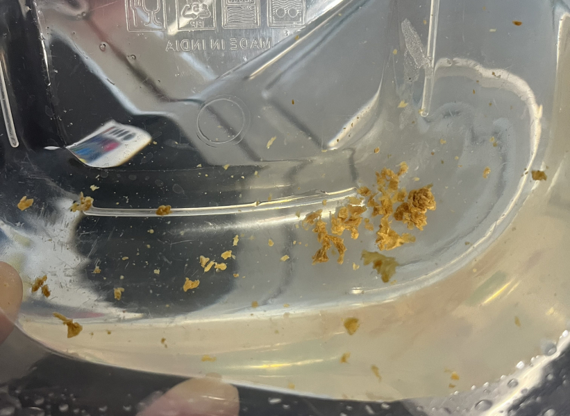 ear wax