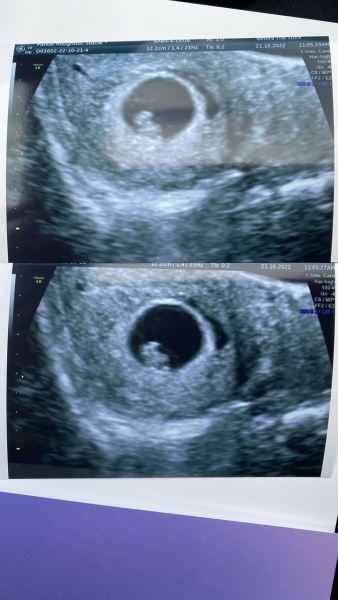 June 2023 Babies 🌞